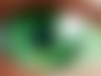 Desarrollan ojo biónico que podría restaurar la visión de personas ciegas