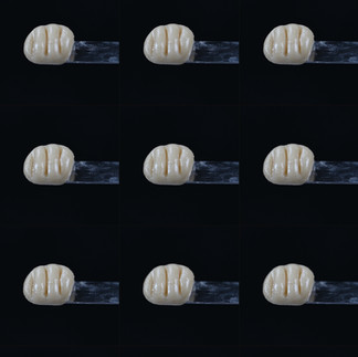 Twelve dental crowns arranged neatly
