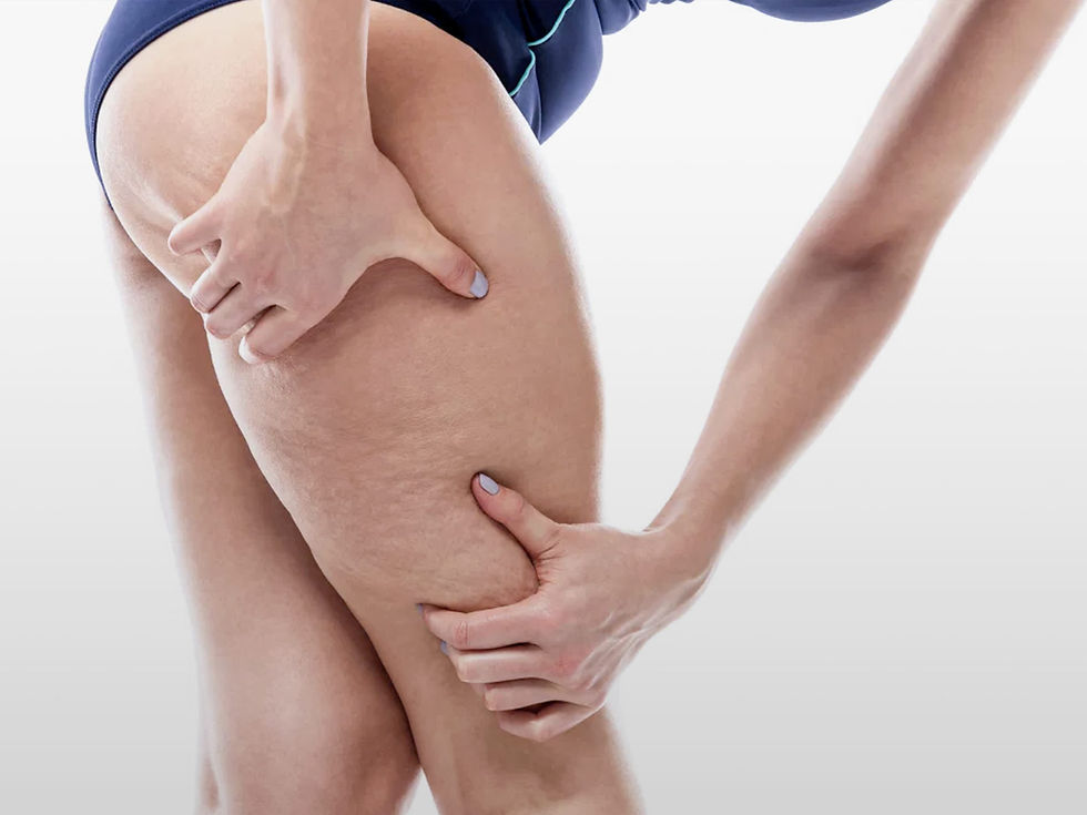 Gamba con cellulite