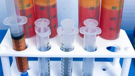 What is Lipofilling? ?