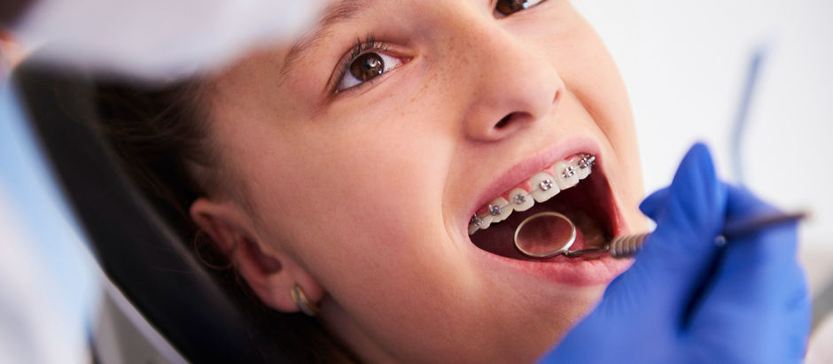 Orthodontic Care, 