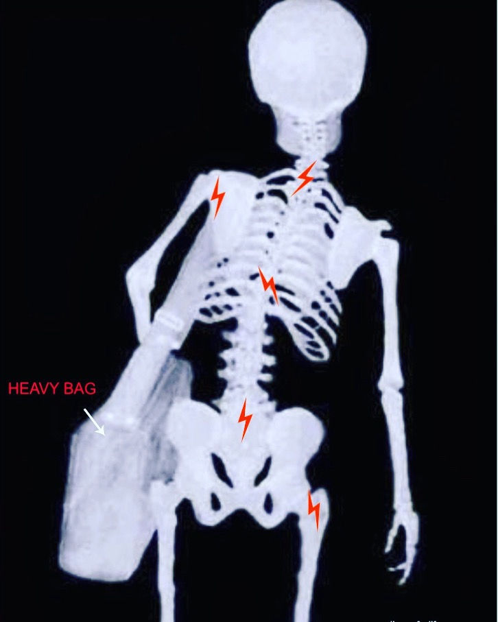 The Hidden Harm of Nocicebos: How Medical Diagnoses Can Create Pain