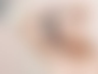 Cilt Kararması Tedavisi Nedir?