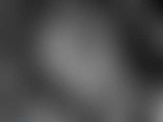 Right Ventricle 2 Chamber View