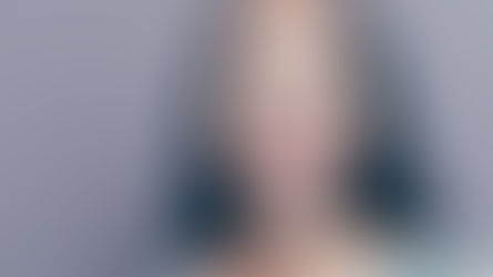 How Can Cosmetic Bonding Improve My Smile? Mckinney, Texas Family & Cosmetic Dentist Answers