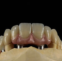 IMG_20210910_130427_485-_1_ (1)_edited.j