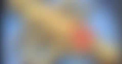 If Saving One Means Losing Another, What Would You Do?: Jodie and Mary’s Conjoined Twins Case