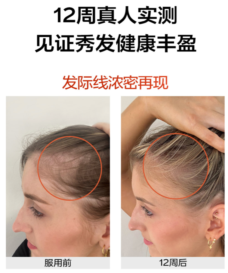 Thumbnail: Vida Glow 蕴发胶囊