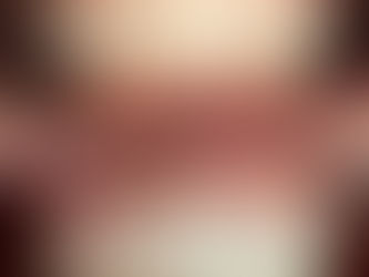 COMO FAZER A MANUTENÇÃO DE UM CLAREAMENTO DENTAL?