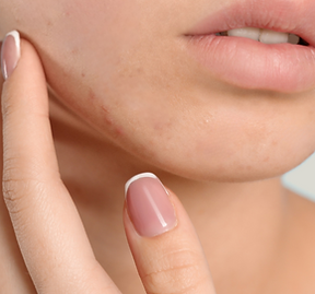 Bella donna con pelle chiara e anti-invecchiamento