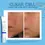 Thumbnail: CLEAR CELL clarifying acne spot treatment