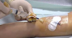 Gestion abords veineux