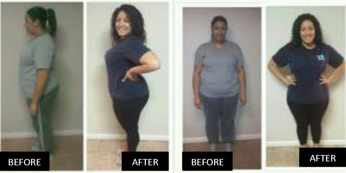 Jillian Before & Afters