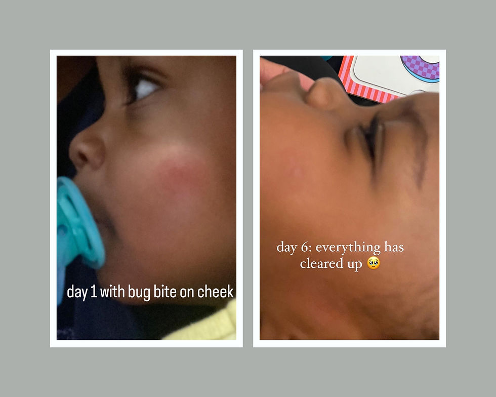Thumbnail: soothie 2.0 body oil.
