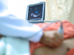 ECOCARDIOGRAMA: ENTENDA MAIS SOBRE ESSE EXAME.