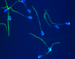 Spermatogenesis-associated proteins uncovered by proteomic analysis