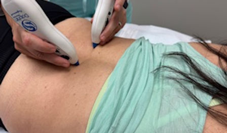 Dolphin Neurostim Pelvic Floor Physical Therapy Exhale spine pain