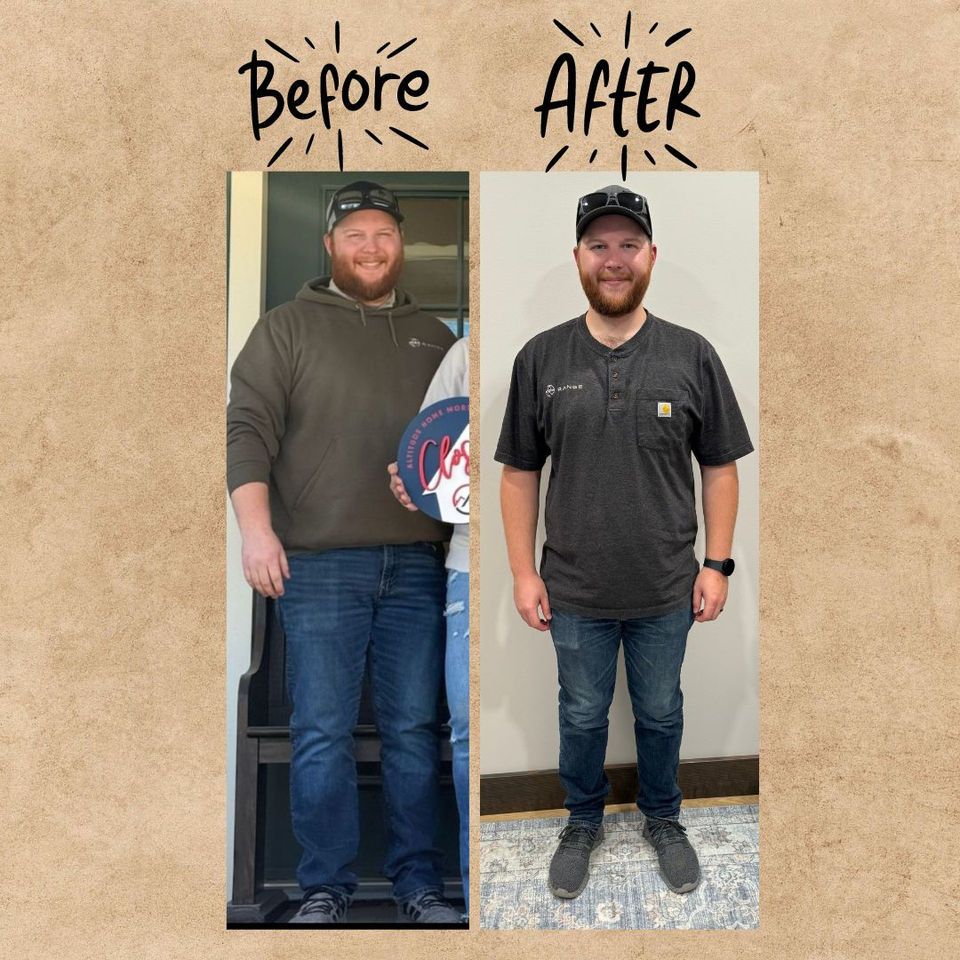 Before and After 1