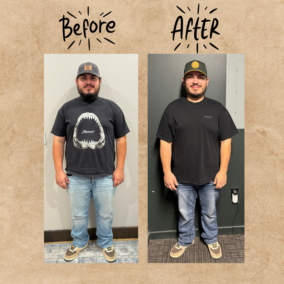 Before and After 5