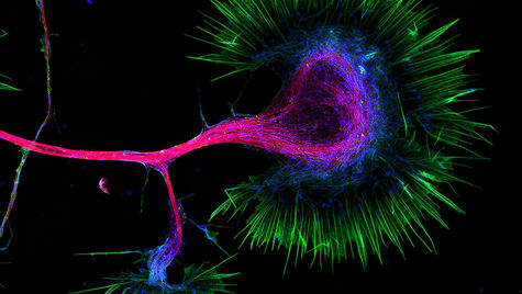 Neurobiology