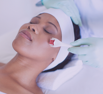 Microagulhamento Facial