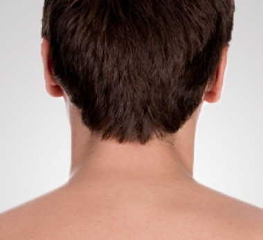 Depilação a laser masculina nuca, homens_edited.jpg