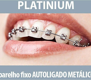 Platinum-Aparelho-fixo-Autoligado-Metalico.jpg