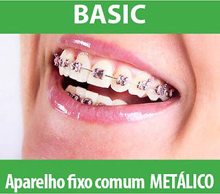 Basic-Aparelho-fixo-comum-metalico.jpg