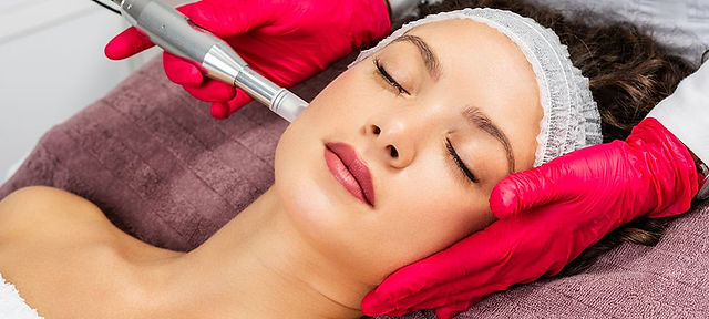 how-much-does-microneedling-cost-in-toronto.jpeg