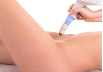 Vaginal Rejuvenation