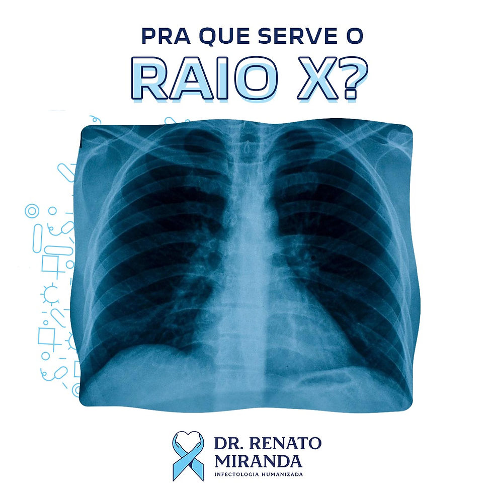 Pra que serve o raio-x?