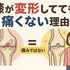 【東大阪市 変形性膝関節症】膝の変形が治ったわけじゃないのに、なぜ痛みはなくなるのか?|上杉整骨院