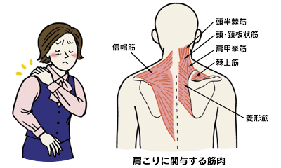 肩こりのよく起きる場所