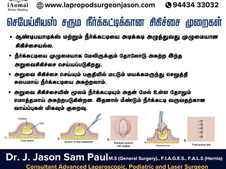 Treatment Methods for Sebaceous Cysts in Tirunelveli