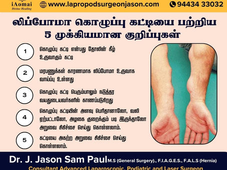 5 Important Tips About Lipoma (Fatty Tumors) in Tirunelveli | Lapropod