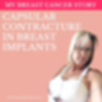 Capsular Contracture