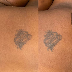 Résultat sur 3 séances