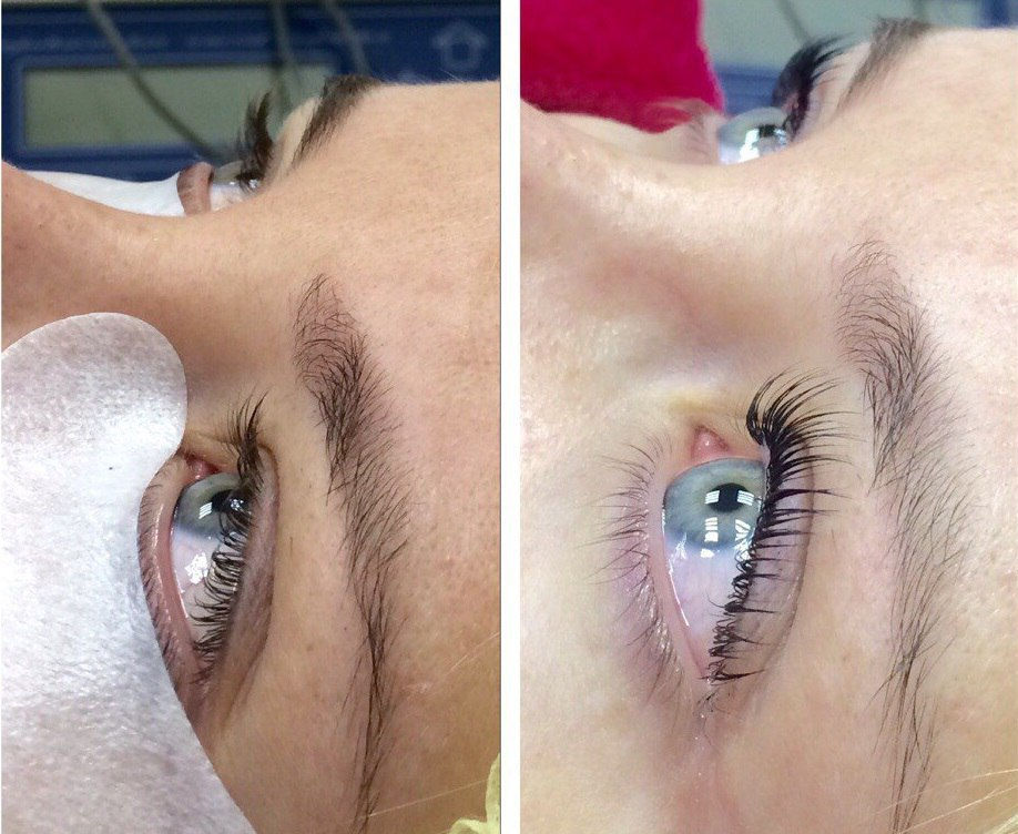 Ламинирование + Ботокс ресниц Botox Lashes