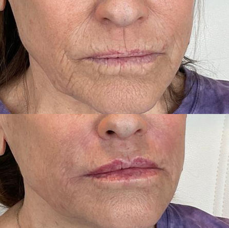 FĀC Aesthetics, facial spa, Argyle Texas