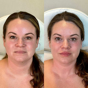 FĀC Aesthetics, facial spa, Argyle Texas