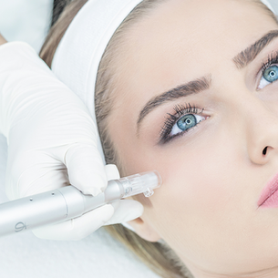 Microneedling