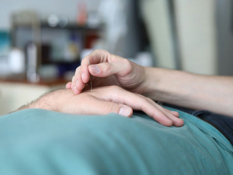 Breaking the Stigma: Acupuncture as a Tool for Men’s Mental Health