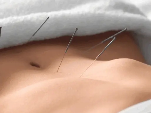 Boosting Fertility Naturally with Acupuncture
