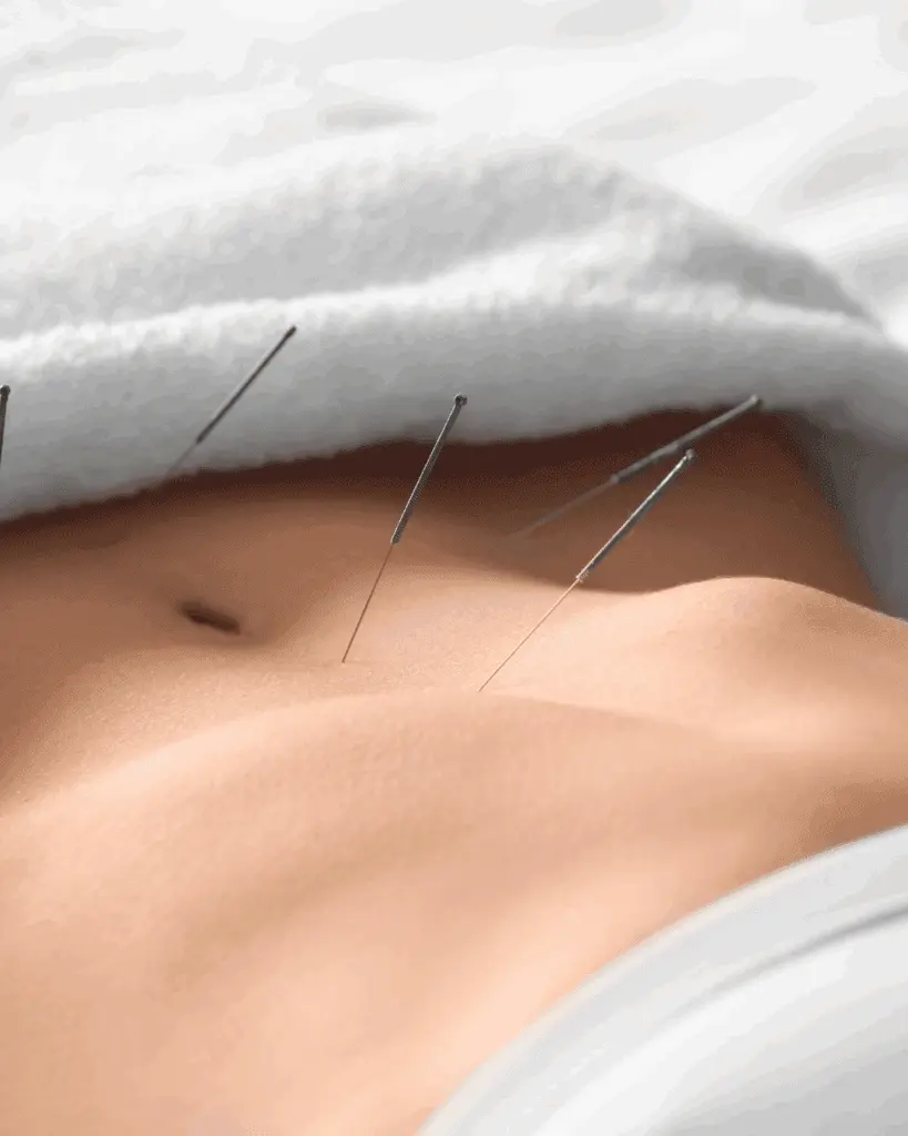 Boosting Fertility Naturally with Acupuncture