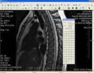 Efilm Workstation 3.1 Serial Download
