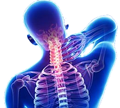 cervical disk herniation treatment in swansea