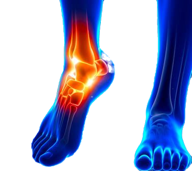 Foot and ankle injuries