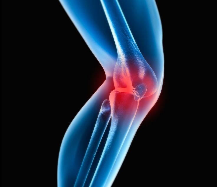 Knee joint injuries