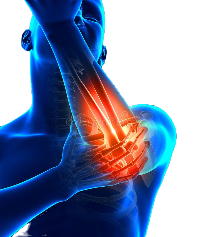 Hand and arm injuries