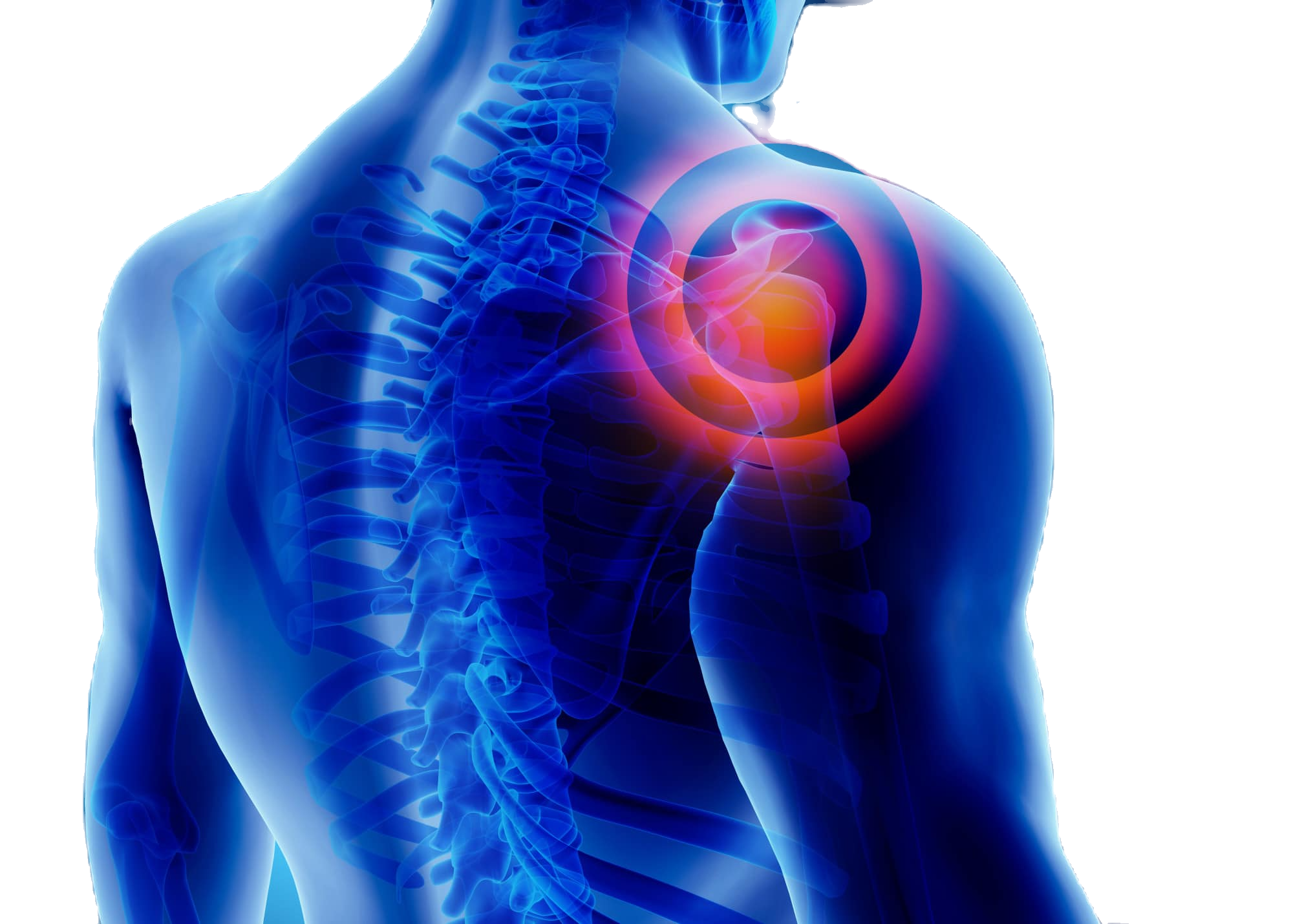 Shoulder injuries